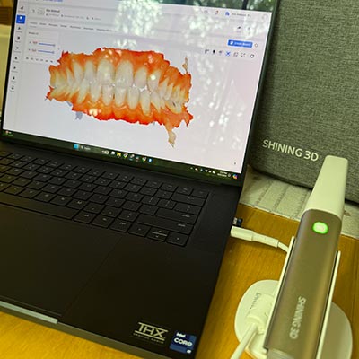 Shining 3D Aoralscan Elite Scanner