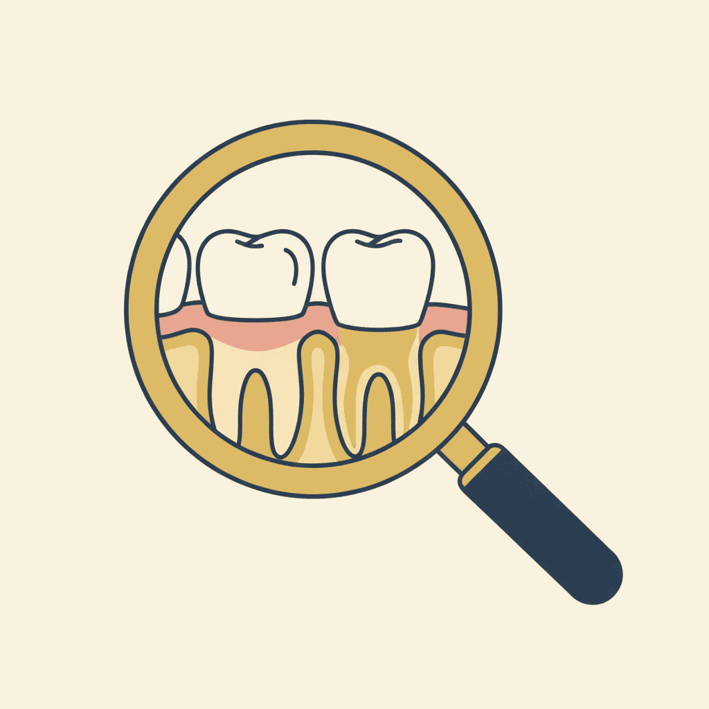 Bone loss under a missing tooth gap before dental implant treatment in Spring Hope NC
