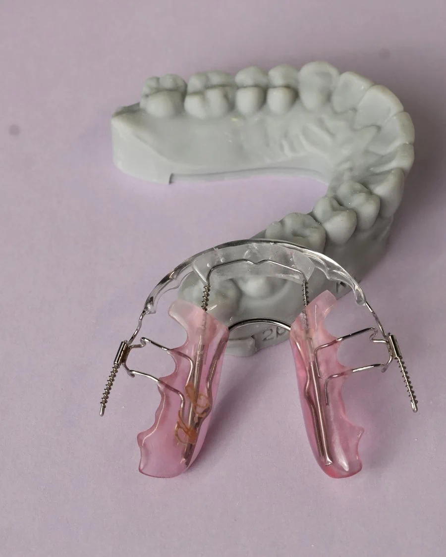 Inman Aligner appliance with coil springs and a clear front bow, shown with a model of the upper teeth