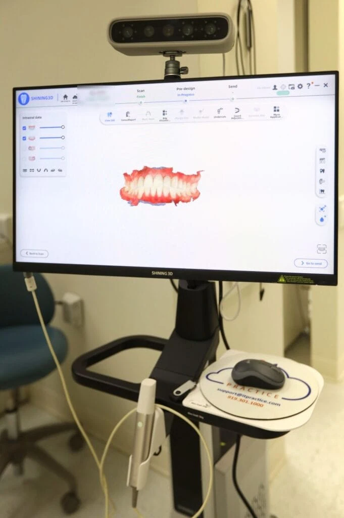Full-color 3D scan of a smile on the intraoral scanner monitor